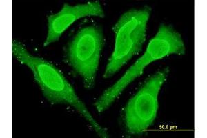 Image no. 2 for anti-Cytoglobin (CYGB) (AA 1-191) antibody (ABIN466266) (CYGB Antikörper  (AA 1-191))