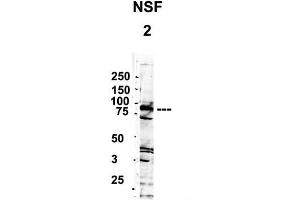 YBX1 antibody - middle region  validated by WB using 1.