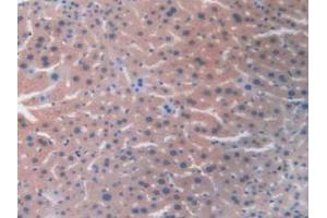 Immunohistochemistry (IHC) image for anti-Resistin (RETN) (AA 21-114) antibody (ABIN7427927)