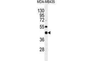 WDR51B Antibody (C-term) western blot analysis in MDA-MB435 cell line lysates (35 µg/lane).
