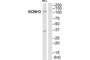 Western Blotting (WB) image for anti-Potassium Voltage-Gated Channel, Subfamily H (Eag-Related), Member 3 (Kcnh3) (Internal Region) antibody (ABIN1851848) (KCNH3 Antikörper  (Internal Region))