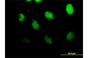 Immunofluorescence of purified MaxPab antibody to CSPG6 on HeLa cell. (SMC3 Antikörper  (AA 1-1217))