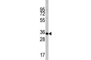 Western blot analysis of Caspase-6 antibody and mouse liver tissue lysate (Caspase 6 Antikörper  (AA 235-263))