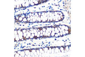 Immunohistochemistry of paraffin-embedded human colon using TFAM Rabbit mAb (ABIN3023684, ABIN3023685, ABIN3023686, ABIN1680049 and ABIN1680050) at dilution of 1:100 (40x lens). (TFAM Antikörper)