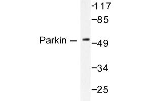 Image no. 1 for anti-Parkinson Protein 2, E3 Ubiquitin Protein Ligase (Parkin) (PARK2) antibody (ABIN271775) (Parkin Antikörper)