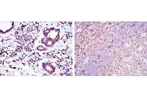 Immunohistochemistry (IHC) image for anti-BH3 Interacting Domain Death Agonist (BID) antibody (ABIN968979)