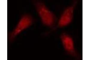ABIN6276417 staining  HeLa cells by IF/ICC. (JUP Antikörper  (C-Term))