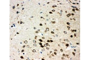 IHC-P: Integrin alpha 3 antibody testing of rat brain tissue (ITGA3 Antikörper  (N-Term))