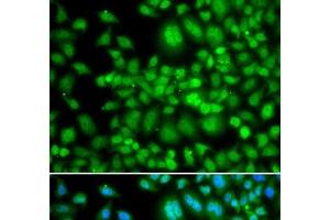 Immunofluorescence analysis of MCF-7 cells using SETD5 Polyclonal Antibody (SETD5 Antikörper)
