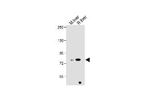 All lanes : Anti-ZBT24 Antibody (N-term) at 1:1000 dilution Lane 1: Mouse liver lysate Lane 2: Rat liver lysate Lysates/proteins at 20 μg per lane. (ZBTB24 Antikörper  (N-Term))