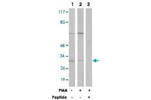 Western blot analysis of extracts from LoVo cells (Lane 1) and Jurkat cells (Lane 2 and 3) treated with PMA (125 ng/mL, 30 min), using MARCKS polyclonal antibody . (MARCKS Antikörper  (Ser162.))