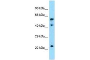 Image no. 1 for anti-Insulin-Like Growth Factor 2 mRNA Binding Protein 1 (IGF2BP1) (AA 90-139) antibody (ABIN6748296)