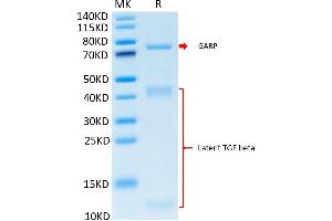 Cynomolgus GARP&Latent TGF beta Complex on Tris-Bis PAGE under reduced condition.
