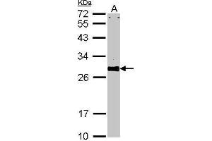 WB Image Sample (30 ug of whole cell lysate) A: NIH-3T3 12% SDS PAGE VAPA antibody antibody diluted at 1:1000 (VAPA Antikörper)