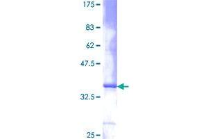 Image no. 1 for Interleukin 8 (IL8) (AA 1-99) protein (GST tag) (ABIN1307847)