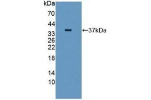 Detection of Recombinant GBP4, Human using Polyclonal Antibody to Guanylate Binding Protein 4 (GBP4) (GBP4 Antikörper  (AA 1-292))