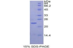 SDS-PAGE (SDS) image for Heparan Sulphate Protoglycans (HSPG) (AA 19-144) protein (His tag) (ABIN1099143)