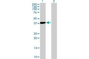 Western Blot analysis of NKX2-5 expression in transfected 293T cell line by NKX2-5 MaxPab polyclonal antibody. (NK2 Homeobox 5 Antikörper  (AA 1-324))