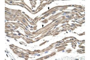 C1QB antibody was used for immunohistochemistry at a concentration of 4-8 ug/ml to stain Skeletal muscle cells (arrows) in Human Muscle. (C1QB Antikörper  (C-Term))