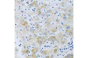Immunohistochemistry of paraffin-embedded human liver using SLC4A5 antibody (ABIN4905205) at dilution of 1:100 (40x lens). (NBC4 Antikörper)