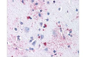 Immunohistochemical staining of Brain Cortex using AP31144PU-N SLC29A1 antibody (SLC29A1 Antikörper  (Internal Region))