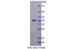 SDS-PAGE (SDS) image for Cyclin-Dependent Kinase Inhibitor 1B (p27, Kip1) (CDKN1B) (AA 2-197) protein (His tag) (ABIN4990247) (CDKN1B Protein (AA 2-197) (His tag))