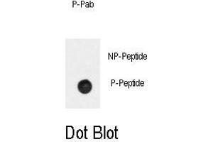 Image no. 1 for anti-Adrenergic, beta-2-, Receptor, Surface (ADRB2) (pSer261) antibody (ABIN358476) (beta 2 Adrenergic Receptor Antikörper  (pSer261))