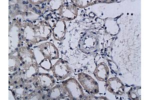 Formalin-fixed and paraffin embedded rat kidney labeled with Anti-TPA/PLAT Polyclonal Antibody, Unconjugated (ABIN731123) followed by conjugation to the secondary antibody and DAB staining (PLAT Antikörper  (AA 485-562))