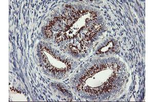 Image no. 4 for anti-Golgi Membrane Protein 1 (GOLM1) antibody (ABIN1498497) (GOLM1 Antikörper)