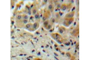 Used in DAB staining on fromalin fixed paraffin-embedded Liver tissue (SERPINA10 Antikörper  (AA 6-125))