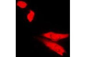 Immunofluorescent analysis of Topoisomerase 2 beta staining in Jurkat cells.