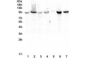 Western blot testing of human 1) HeLa, 2) COLO-320, 3) HepG2, 4) MCF7, 5) SW620, 6) 22RV1 and 7) Jurkat lysate with Beta Catenin antibody. (beta Catenin Antikörper  (AA 2-233))