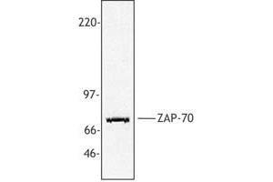 Image no. 1 for anti-zeta-Chain (TCR) Associated Protein Kinase 70kDa (ZAP70) (AA 282-307) antibody (ABIN205364) (ZAP70 Antikörper  (AA 282-307))