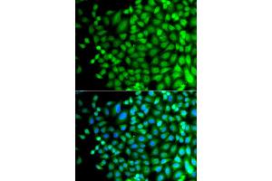 Immunofluorescence analysis of A549 cells using SUPT20H antibody. (FAM48A/P38IP Antikörper)