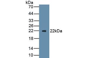 Detection of Recombinant AVIL, Mouse using Polyclonal Antibody to Advillin (AVIL) (Advillin Antikörper  (AA 1-160))