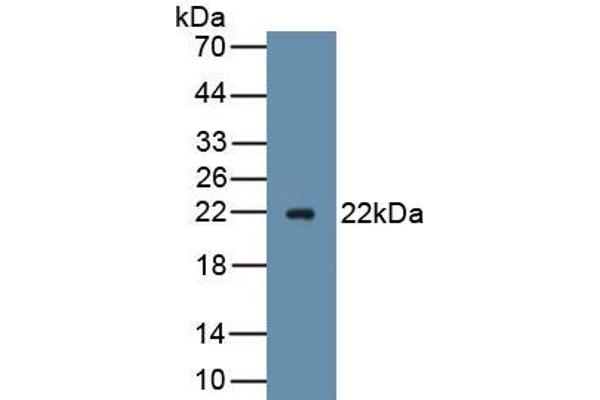 Advillin Antikörper  (AA 1-160)