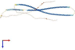 Keratin 86 Protein (KRT86) (AA 1-486) (His tag)