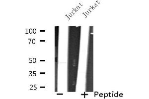 Western blot analysis of extracts from Jurkat cells, using TEAD3 antibody. (TEAD3 Antikörper  (Internal Region))