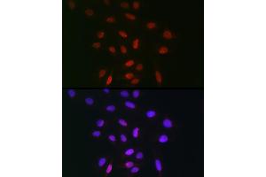Immunofluorescence analysis of U-2 OS cells using TDP1 Rabbit pAb (ABIN1682992, ABIN3019238, ABIN3019239 and ABIN6220782) at dilution of 1:100 (40x lens).