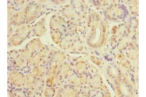 Immunohistochemistry of paraffin-embedded human pancreatic tissue using ABIN7171606 at dilution of 1:100 (TBC1D19 Antikörper  (AA 1-300))