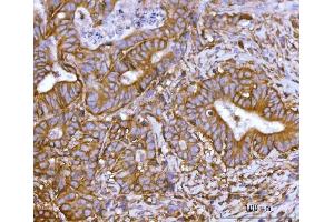 IHC analysis of SNAP23 using anti-SNAP23 antibody (ABIN7599089). (SNAP23 Antikörper  (AA 1-211))