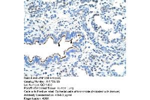 Human Lung (ZNF239 Antikörper  (Middle Region))