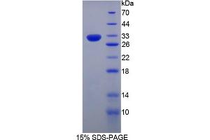 Image no. 1 for CASP8 and FADD-Like Apoptosis Regulator (CFLAR) (AA 43-281) protein (His tag) (ABIN6238308) (FLIP Protein (AA 43-281) (His tag))