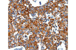 Immunohistochemistry (IHC) image for anti-Kallikrein 2 (KLK2) antibody (ABIN1873440) (Kallikrein 2 Antikörper)