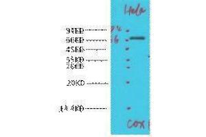 Western Blotting (WB) image for anti-Cytochrome C Oxidase Subunit I (COX1) antibody (ABIN3181265) (COX1 Antikörper)
