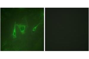 Immunofluorescence analysis of NIH-3T3 cells, using 14-3-3 zeta/delta (Ab-232) Antibody. (14-3-3 zeta Antikörper  (AA 196-245))