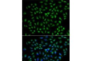 Immunofluorescence analysis of U2OS cells using RBPJ Polyclonal Antibody (RBPJ Antikörper)