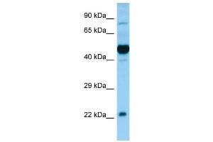WB Suggested Anti-HCRTR1 Antibody Titration: 0. (HCRTR1 Antikörper  (N-Term))