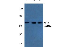 Western blot (WB) analysis of p-AKT2 antibody at 1/500 dilution (AKT2 Antikörper  (pSer474))