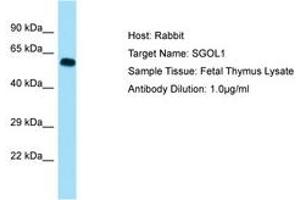 Image no. 1 for anti-Shugoshin 1 (SGOL1) (AA 395-444) antibody (ABIN6749951) (Shugoshin Antikörper  (AA 395-444))
